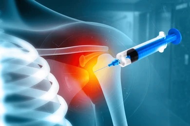 Ultrasound-Guided Injection Shoulder